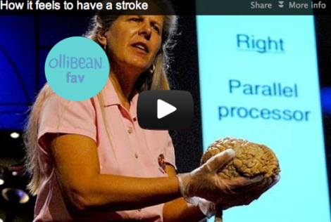 Photo of Jill Bolte Taylor holding a brain during her TedTalk. The text, How it feels to have a stroke, is in the upper left hand corner
</p srcset=